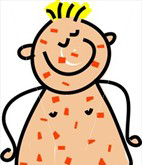 Chicken Pox